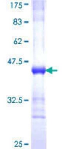 Novus Biologicals Recombinant Human Sec8 GST (N-Term) Protein 10 &mu;g | Buy Online | Novus Biologicals&trade; | Fisher Scientific