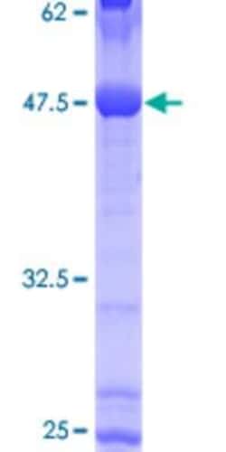 Novus Biologicals Recombinant Human Cadherin-26 GST (N-Term) Protein 10 &mu;g | Buy Online | Novus Biologicals&trade; | Fisher Scientific