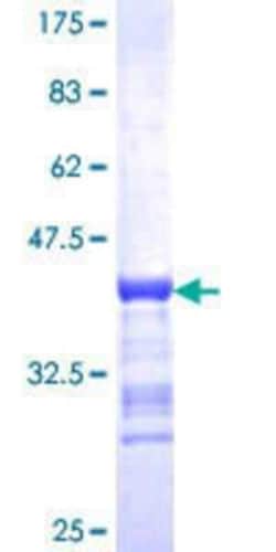 Novus Biologicals Recombinant Human BACH2 GST (N-Term) Protein 10 &mu;g | Buy Online | Novus Biologicals&trade; | Fisher Scientific