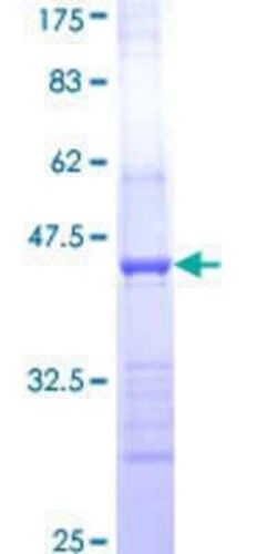 Novus Biologicals Recombinant Human HAPLN2 GST (N-Term) Protein 25 &mu;g | Buy Online | Novus Biologicals&trade; | Fisher Scientific