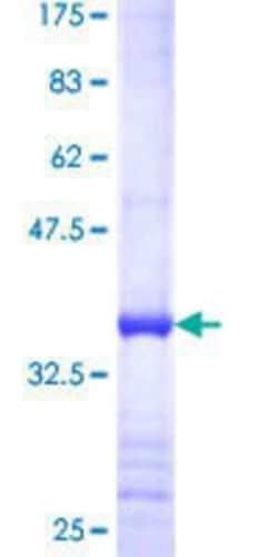 Novus Biologicals Recombinant Human SAV1 GST (N-Term) Protein 25 &mu;g | Buy Online | Novus Biologicals&trade; | Fisher Scientific