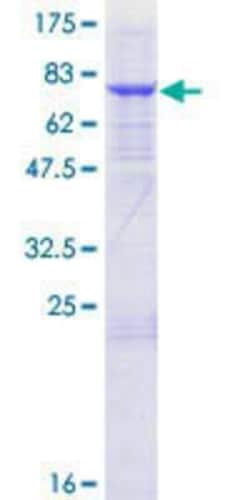 Novus Biologicals Recombinant Human TRM11 GST (N-Term) Protein 25 &mu;g | Buy Online | Novus Biologicals&trade; | Fisher Scientific
