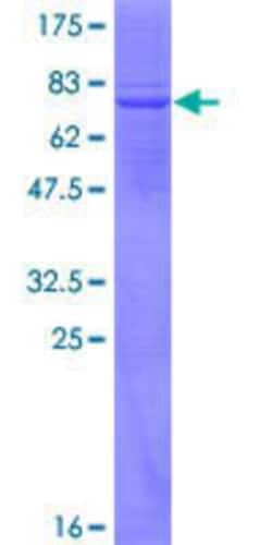 Novus Biologicals Recombinant Human APOBEC3G GST (N-Term) Protein 25 &mu;g | Buy Online | Novus Biologicals&trade; | Fisher Scientific