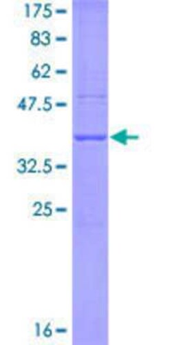 Novus Biologicals Recombinant Human APOBEC3G GST (N-Term) Protein 25 &mu;g | Buy Online | Novus Biologicals&trade; | Fisher Scientific