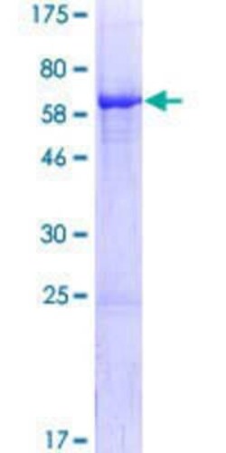 Novus Biologicals Recombinant Human NIF3L1 GST (N-Term) Protein 10 &mu;g | Buy Online | Novus Biologicals&trade; | Fisher Scientific