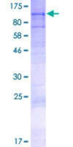 Novus Biologicals Recombinant Human AGBL5 GST (N-Term) Protein 2 &mu;g | Buy Online | Novus Biologicals&trade; | Fisher Scientific