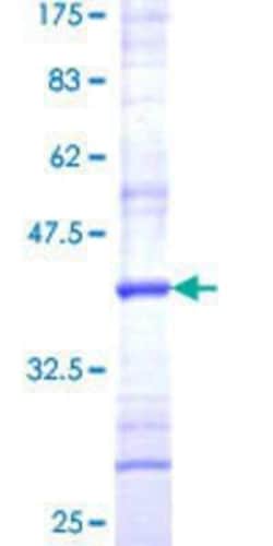 Novus Biologicals Recombinant Human SPCS3 GST (N-Term) Protein 25 &mu;g | Buy Online | Novus Biologicals&trade; | Fisher Scientific