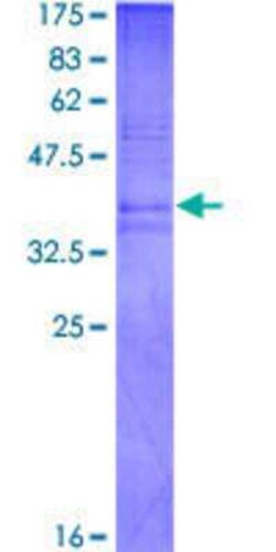 Novus Biologicals Recombinant Human Prokineticin 2 GST (N-Term) Protein 2 &mu;g | Buy Online | Novus Biologicals&trade; | Fisher Scientific