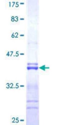 Novus Biologicals Recombinant Human RNF123 GST (N-Term) Protein 25 &mu;g | Buy Online | Novus Biologicals&trade; | Fisher Scientific