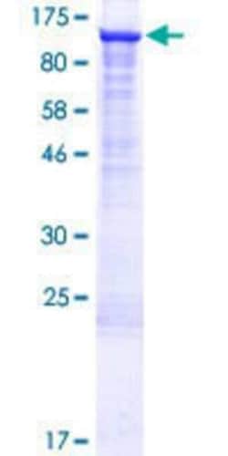 Novus Biologicals Recombinant Human UBE2O GST (N-Term) Protein 10 &mu;g | Buy Online | Novus Biologicals&trade; | Fisher Scientific