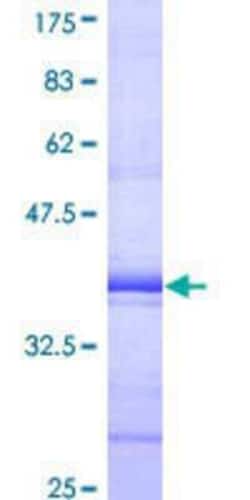 Novus Biologicals Recombinant Human SH2D4A GST (N-Term) Protein 25 &mu;g | Buy Online | Novus Biologicals&trade; | Fisher Scientific