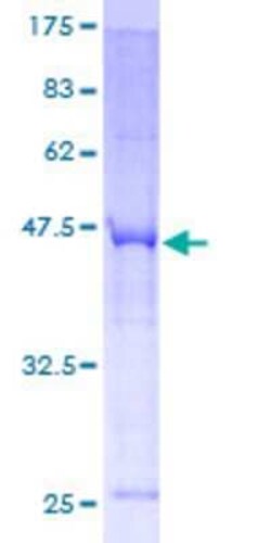 Novus Biologicals Recombinant Human CIDEC GST (N-Term) Protein 10 &mu;g | Buy Online | Novus Biologicals&trade; | Fisher Scientific