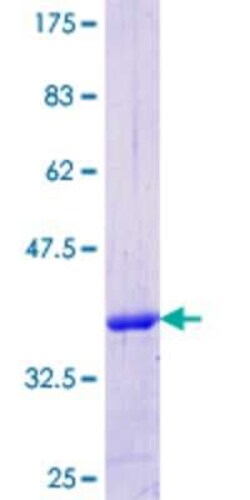 Novus Biologicals Recombinant Human CIDEC GST (N-Term) Protein 25 &mu;g | Buy Online | Novus Biologicals&trade; | Fisher Scientific