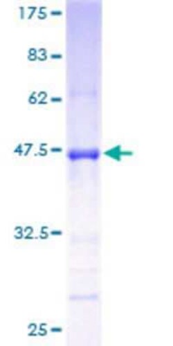 Novus Biologicals Recombinant Human GPSM3 GST (N-Term) Protein 25 &mu;g | Buy Online | Novus Biologicals&trade; | Fisher Scientific
