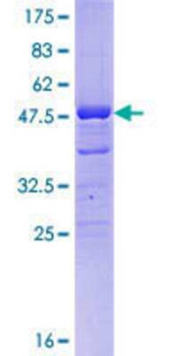 Novus Biologicals Recombinant Human DMRTB1 GST (N-Term) Protein 10 &mu;g | Buy Online | Novus Biologicals&trade; | Fisher Scientific