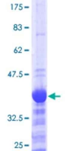 Novus Biologicals&trade;&nbsp;Recombinant Human Neurogenin-2 GST (N-Term) Protein