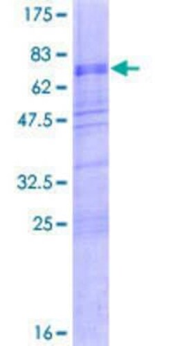 Novus Biologicals Recombinant Human MATH2/NEUROD6 GST (N-Term) Protein 2 &mu;g | Buy Online | Novus Biologicals&trade; | Fisher Scientific