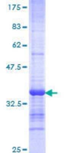 Novus Biologicals Recombinant Human Cadherin-23 GST (N-Term) Protein 10 &mu;g | Buy Online | Novus Biologicals&trade; | Fisher Scientific