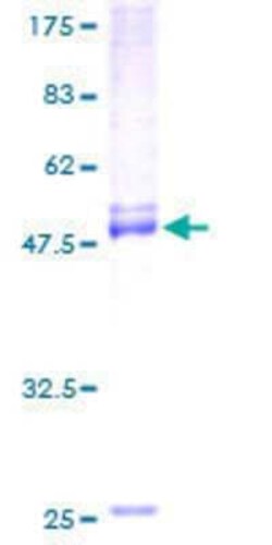 Novus Biologicals Recombinant Human ELSPBP1 GST (N-Term) Protein 10 &mu;g | Buy Online | Novus Biologicals&trade; | Fisher Scientific