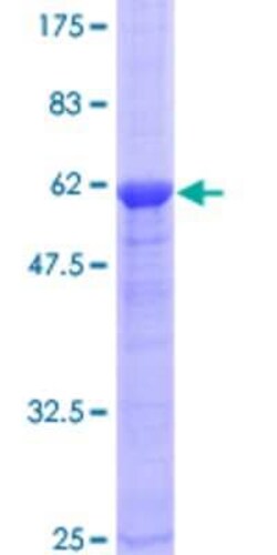 Novus Biologicals Recombinant Human CENPK GST (N-Term) Protein 10 &mu;g | Buy Online | Novus Biologicals&trade; | Fisher Scientific
