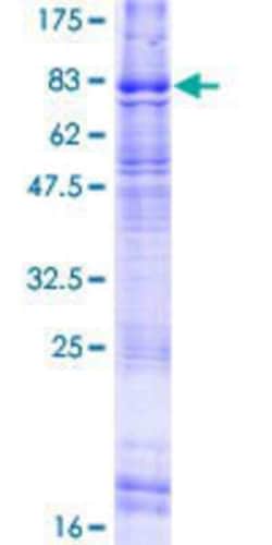 Novus Biologicals Recombinant Human ELTD1/ETL GST (N-Term) Protein 10 &mu;g | Buy Online | Novus Biologicals&trade; | Fisher Scientific