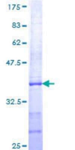 Novus Biologicals Recombinant Human ELTD1/ETL GST (N-Term) Protein 10 &mu;g | Buy Online | Novus Biologicals&trade; | Fisher Scientific
