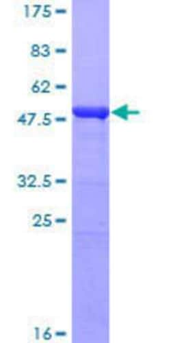 Novus Biologicals&trade;&nbsp;Recombinant Human MDA5 GST (N-Term) Protein