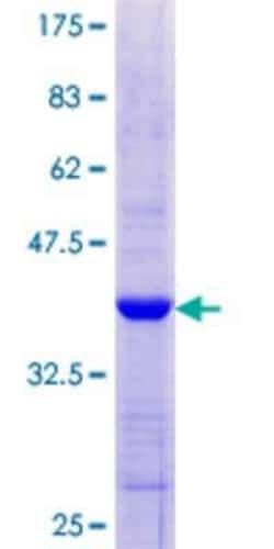 Novus Biologicals Recombinant Human MDA5 GST (N-Term) Protein 10 &mu;g | Buy Online | Novus Biologicals&trade; | Fisher Scientific