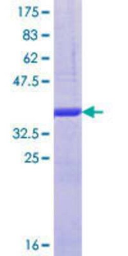 Novus Biologicals Recombinant Human KIF9 GST (N-Term) Protein 10 &mu;g | Buy Online | Novus Biologicals&trade; | Fisher Scientific