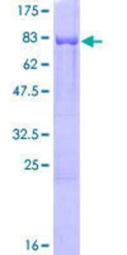 Novus Biologicals Recombinant Human CARD9 GST (N-Term) Protein 10 &mu;g | Buy Online | Novus Biologicals&trade; | Fisher Scientific