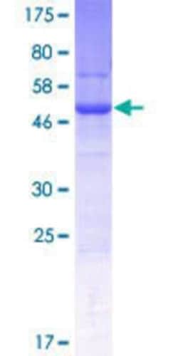 Novus Biologicals&trade;&nbsp;Recombinant Human Spermatogensis associated protein 1 GST (N-Term) Protein