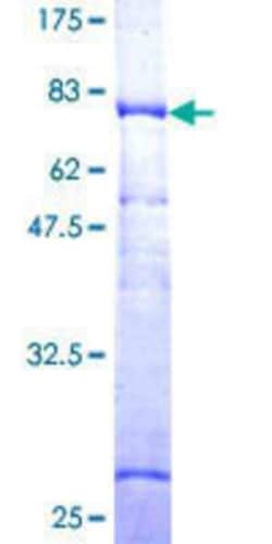 Novus Biologicals Recombinant Human LEPRE1 GST (N-Term) Protein 10 &mu;g | Buy Online | Novus Biologicals&trade; | Fisher Scientific