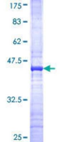 Novus Biologicals Recombinant Human LHX5 GST (N-Term) Protein 10 &mu;g | Buy Online | Novus Biologicals&trade; | Fisher Scientific