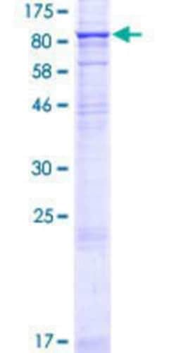 Novus Biologicals&trade;&nbsp;Recombinant Human STRA6 GST (N-Term) Protein