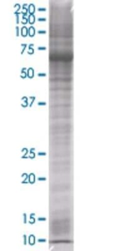 Novus Biologicals ROBO3 293T Cell Transient Overexpression Lysate 0.1 mL | Buy Online | Novus Biologicals&trade; | Fisher Scientific