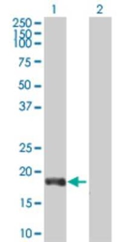 Novus Biologicals ROBO3 293T Cell Transient Overexpression Lysate 0.1 mL | Buy Online | Novus Biologicals&trade; | Fisher Scientific