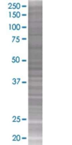 Novus Biologicals ROBO3 293T Cell Transient Overexpression Lysate 0.1 mL | Buy Online | Novus Biologicals&trade; | Fisher Scientific