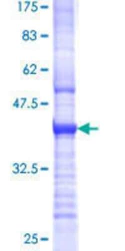 Novus Biologicals Recombinant Human TOR3A GST (N-Term) Protein 25 &mu;g | Buy Online | Novus Biologicals&trade; | Fisher Scientific