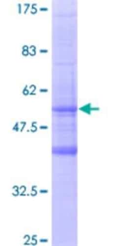 Novus Biologicals Recombinant Human MS4A6A GST (N-Term) Protein 10 &mu;g | Buy Online | Novus Biologicals&trade; | Fisher Scientific