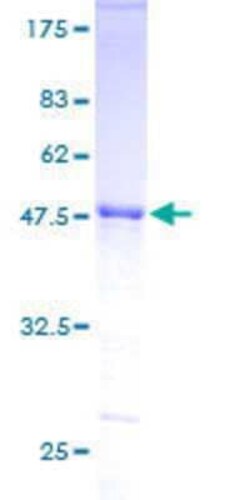 Novus Biologicals Recombinant Human ZNF323 GST (N-Term) Protein 10 &mu;g | Buy Online | Novus Biologicals&trade; | Fisher Scientific