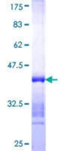 Novus Biologicals Recombinant Human NOC3L GST (N-Term) Protein 10 &mu;g | Buy Online | Novus Biologicals&trade; | Fisher Scientific