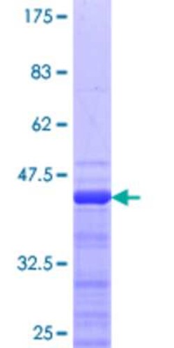 Novus Biologicals Recombinant Human RNF25 GST (N-Term) Protein 10 &mu;g | Buy Online | Novus Biologicals&trade; | Fisher Scientific