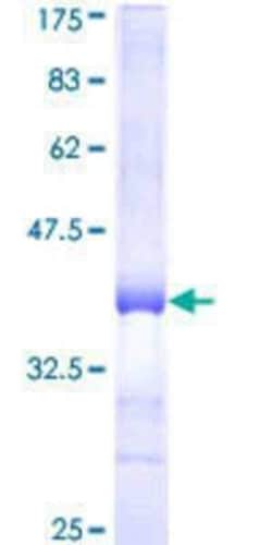 Novus Biologicals&trade;&nbsp;Recombinant Human COP1 GST (N-Term) Protein