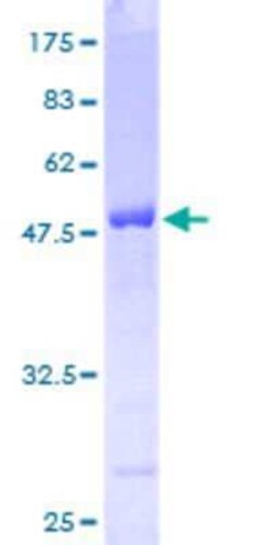 Novus Biologicals Recombinant Human HS1BP3 GST (N-Term) Protein 25 &mu;g | Buy Online | Novus Biologicals&trade; | Fisher Scientific