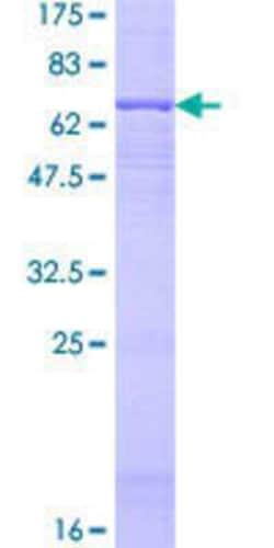 Novus Biologicals Recombinant Human HIF-3 alpha GST (N-Term) Protein 10 &mu;g | Buy Online | Novus Biologicals&trade; | Fisher Scientific