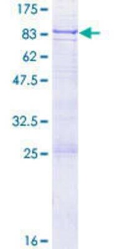 Novus Biologicals Recombinant Human GMCL1 GST (N-Term) Protein 25 &mu;g | Buy Online | Novus Biologicals&trade; | Fisher Scientific