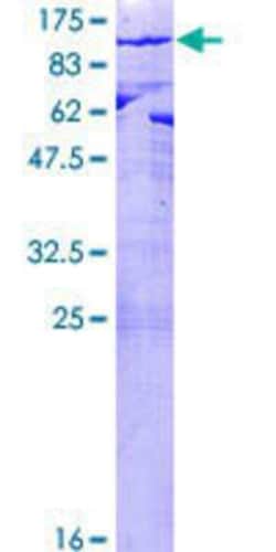Novus Biologicals Recombinant Human PALS1/MPP5 GST (N-Term) Protein 25 &mu;g | Buy Online | Novus Biologicals&trade; | Fisher Scientific