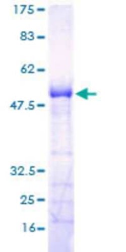 Novus Biologicals Recombinant Human RGS18 GST (N-Term) Protein 10 &mu;g | Buy Online | Novus Biologicals&trade; | Fisher Scientific