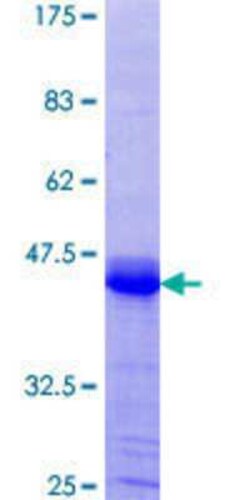 Novus Biologicals Recombinant Human Artemis GST (N-Term) Protein 25 &mu;g | Buy Online | Novus Biologicals&trade; | Fisher Scientific
