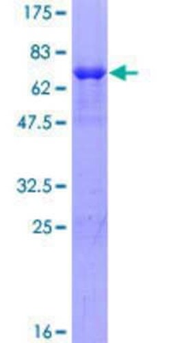 Novus Biologicals&trade;&nbsp;Recombinant Human SDS3 GST (N-Term) Protein
